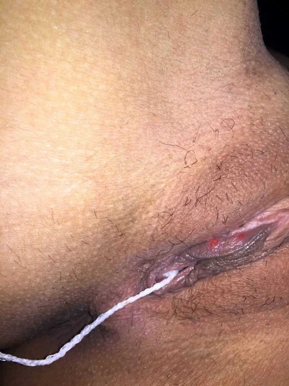 0Abd654C
