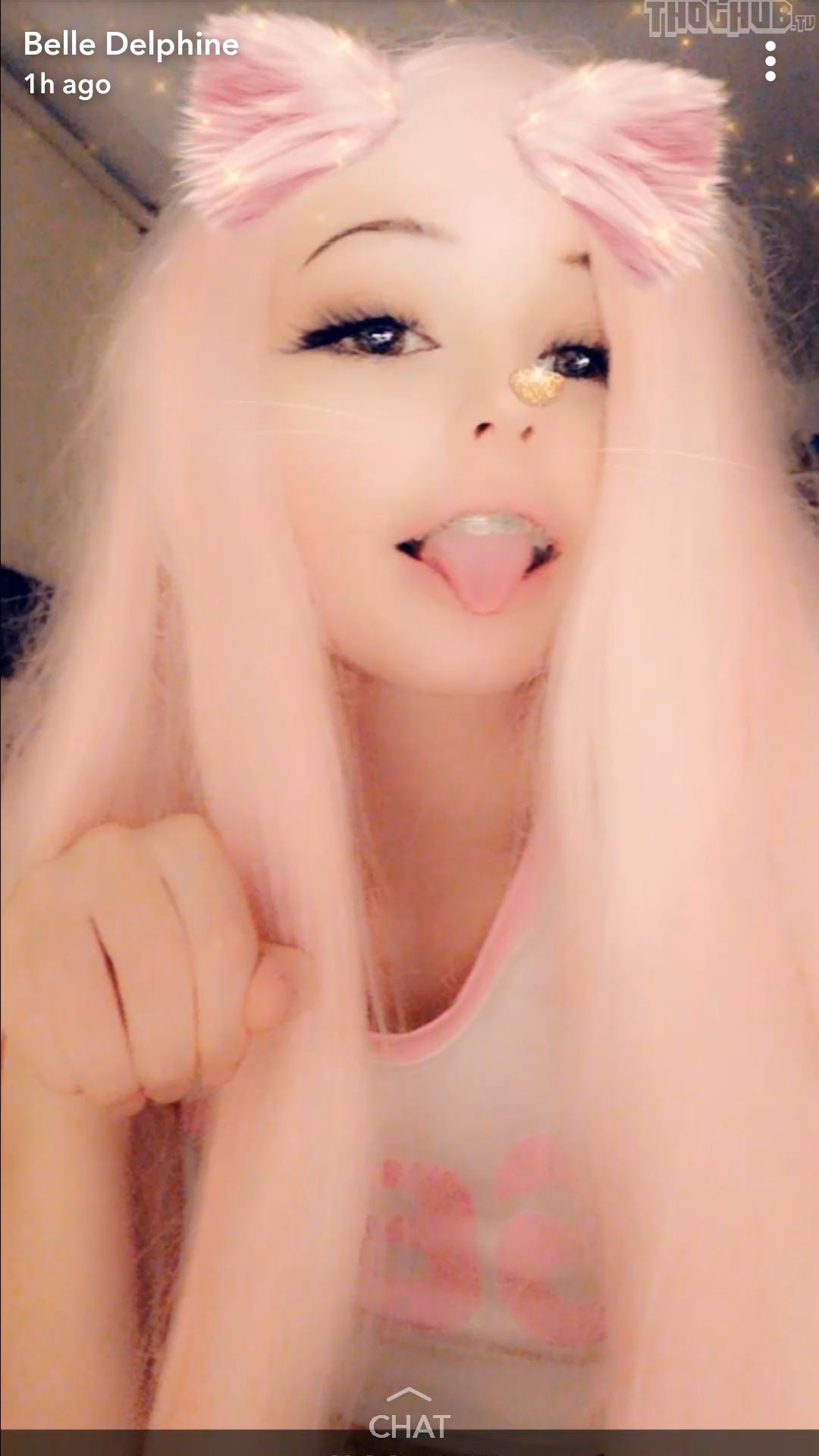 7D101A75