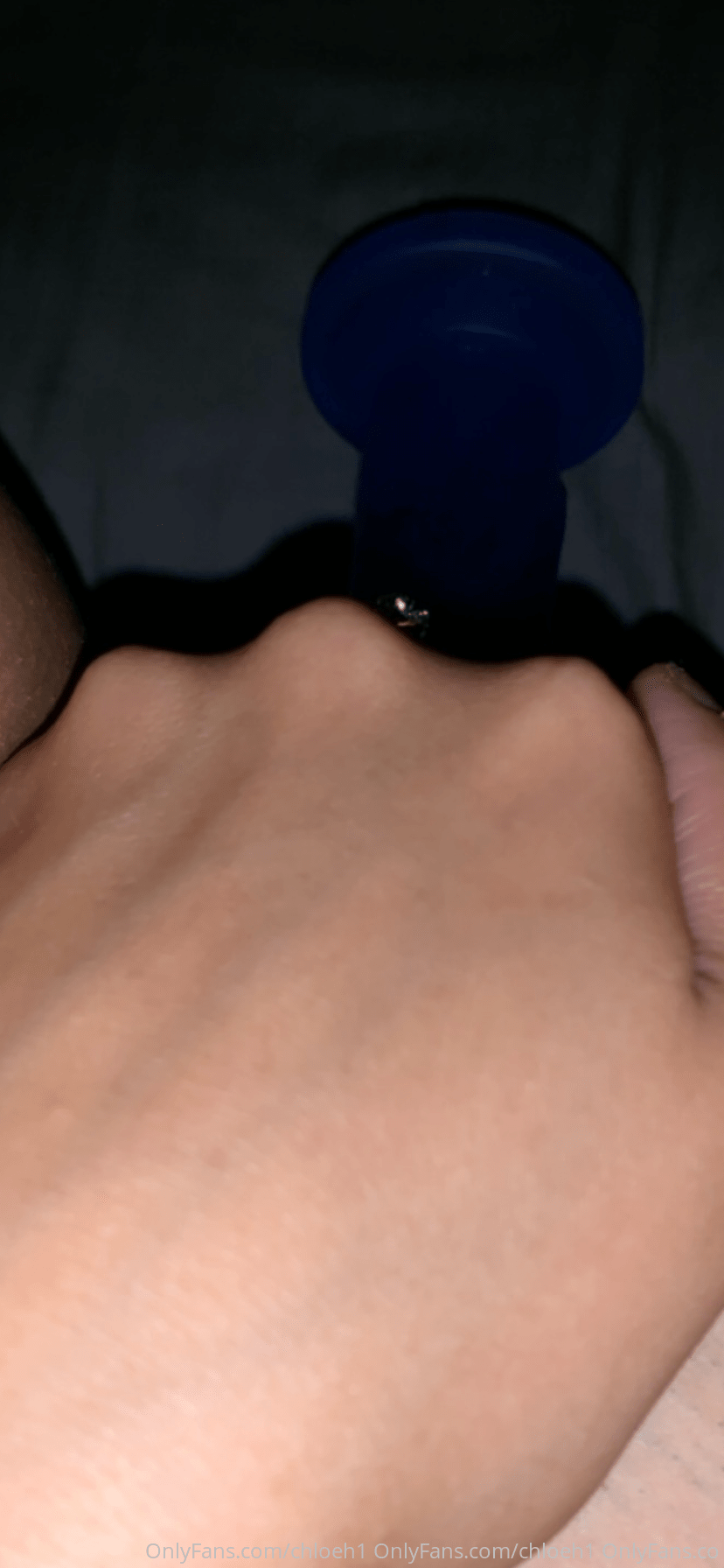 C0151875