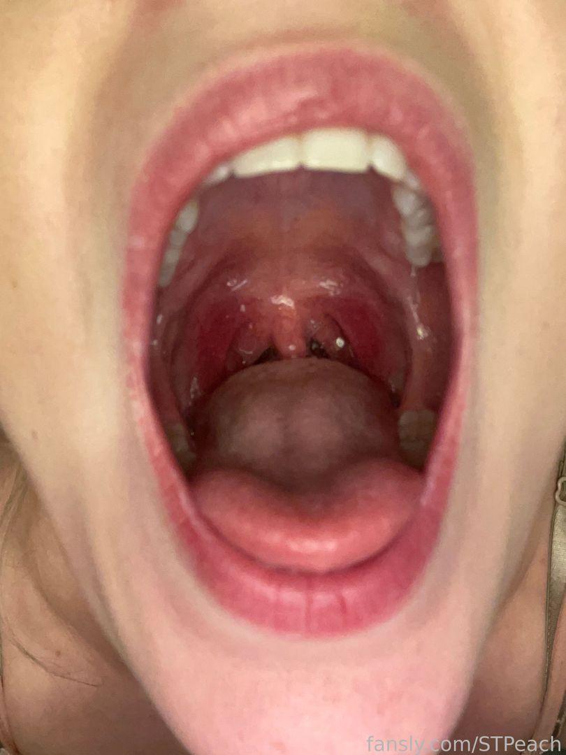 9Cd5Ab17